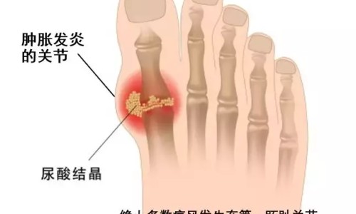 肾结石病人能吃丑橘网-分享肾结石病人能吃黄豆吗，肾结石病人能吃黄豆吗知识库